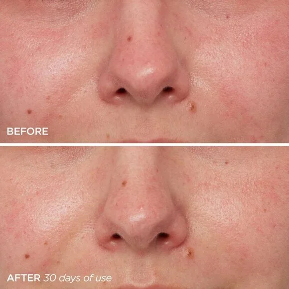 The Daily SERUM NIP - Picture 9 of 9